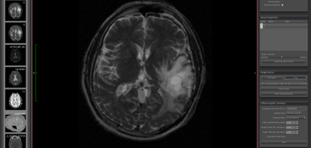 MedINRIA x64 screenshot