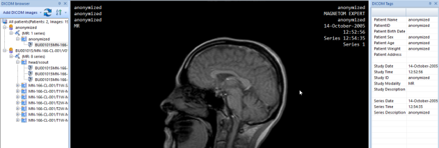 MicroDicom x64 screenshot