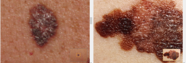 Photo Side-by-Side screenshot