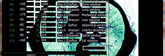 Urografin screenshot