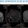 XRayline Workstation